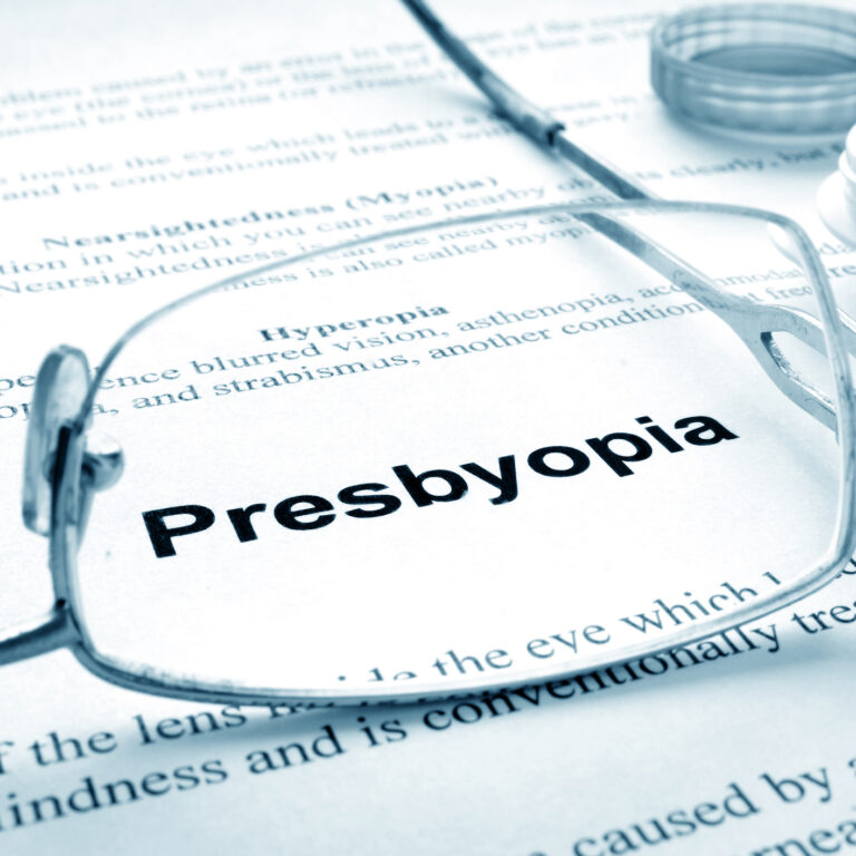 Beyond Presbyopia: Off-Label Uses of Miotics
