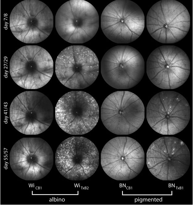 Clinical Application of OCT and cSLO Data in the Glaucoma Diagnostic Process
